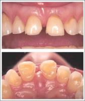 Westpark Dental-Dr. Keith S. Tang, DDS image 7